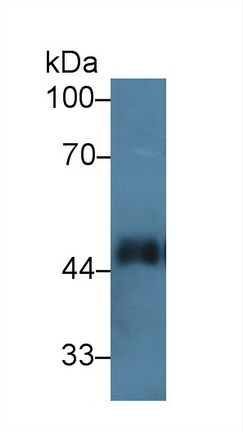 Polyclonal Antibody to Interleukin 1 Receptor Like Protein 1 (IL1RL1)