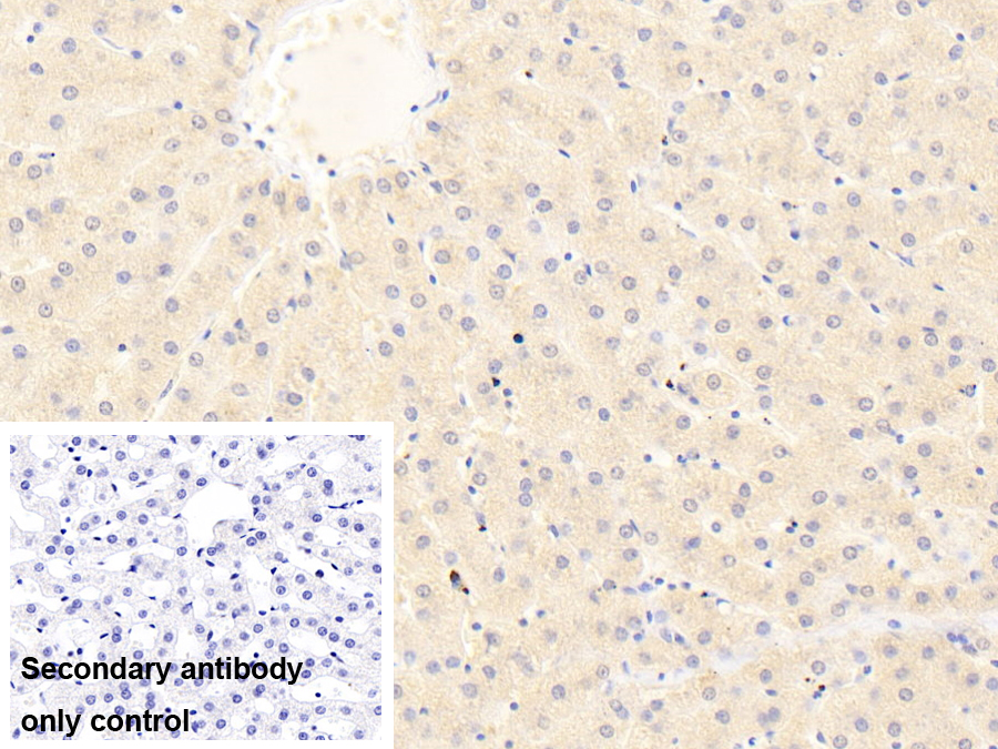 Polyclonal Antibody to Interleukin 1 Receptor Like Protein 1 (IL1RL1)