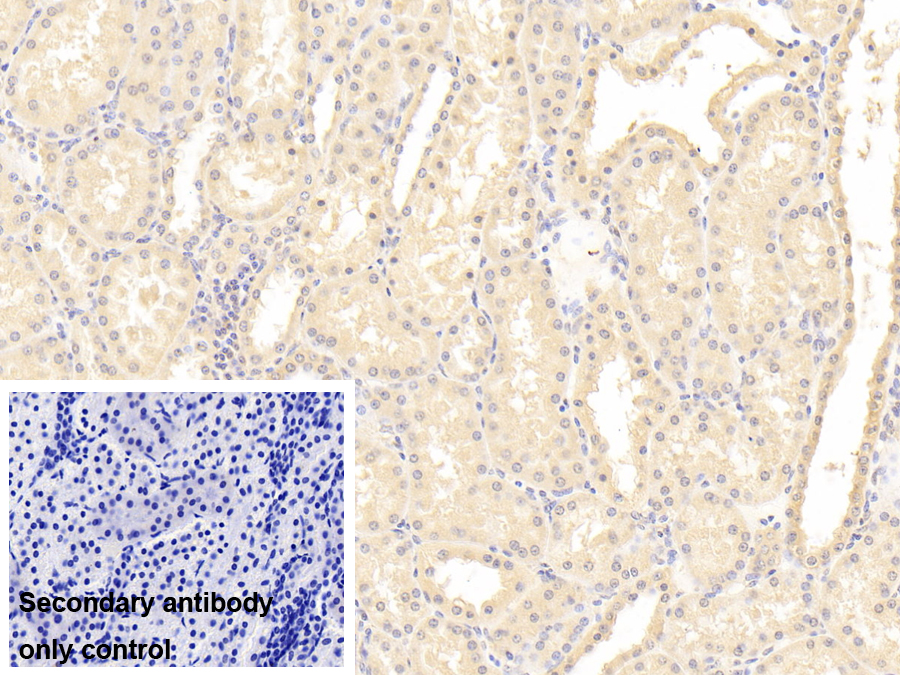 Polyclonal Antibody to Interleukin 1 Receptor Like Protein 1 (IL1RL1)