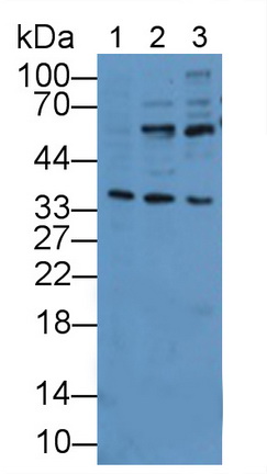 Polyclonal Antibody to Interleukin 1 Receptor Like Protein 1 (IL1RL1)