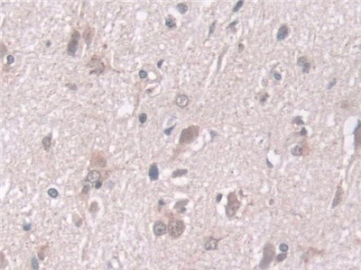 Polyclonal Antibody to Exosome Component 2 (EXOSC2)