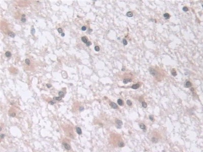 Polyclonal Antibody to Exosome Component 2 (EXOSC2)