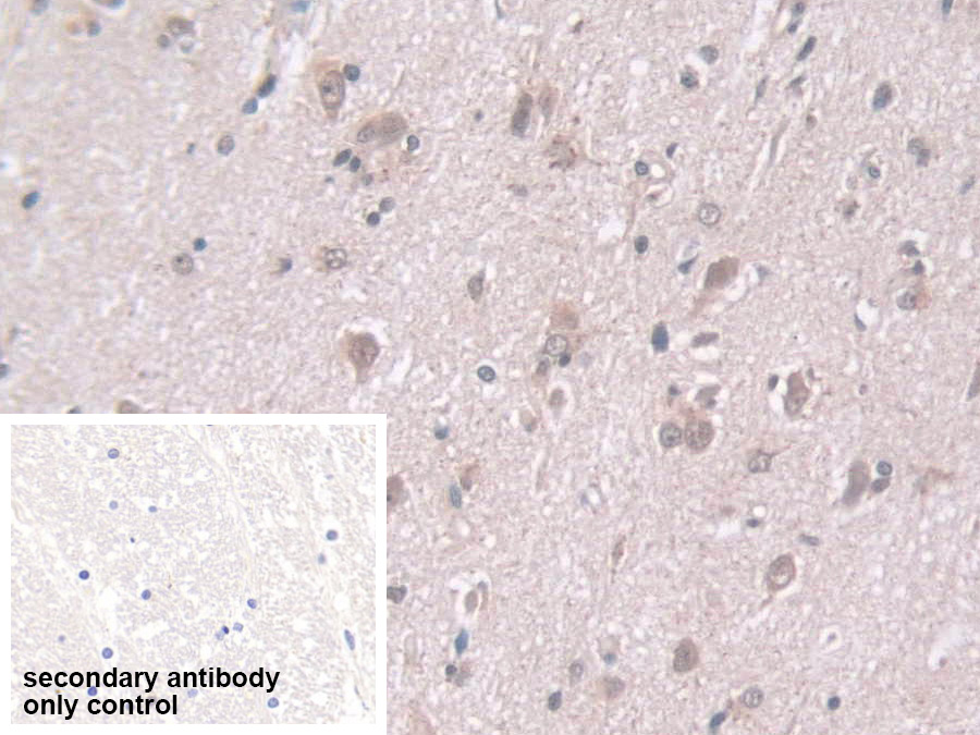 Polyclonal Antibody to Exosome Component 2 (EXOSC2)