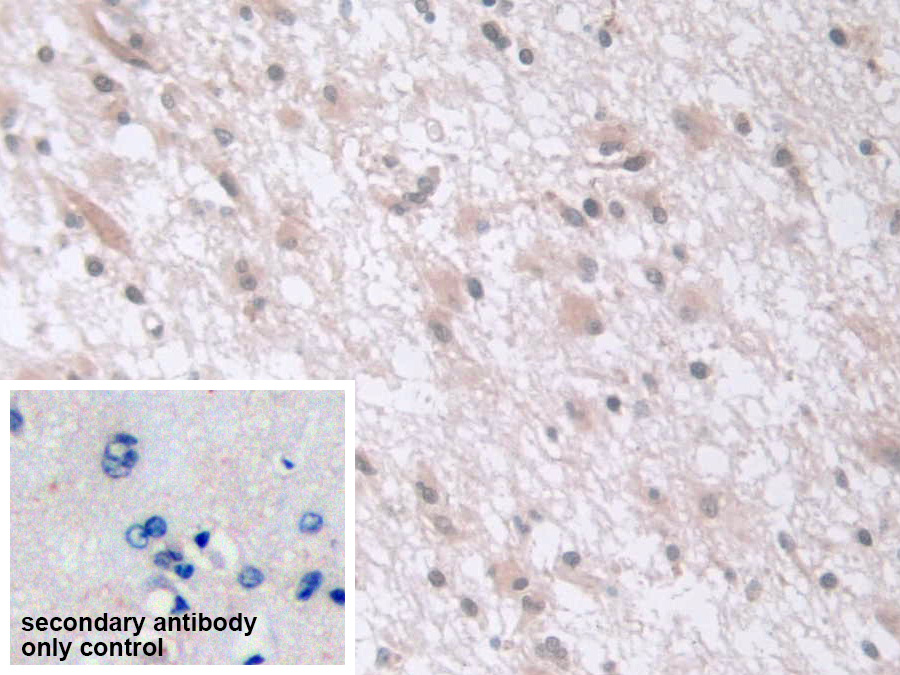 Polyclonal Antibody to Exosome Component 2 (EXOSC2)