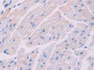 Polyclonal Antibody to Iduronate-2-Sulfatase (IDS)