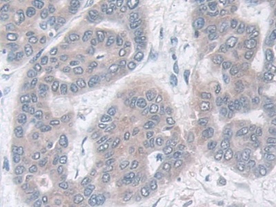 Polyclonal Antibody to Isocitrate Dehydrogenase 2, mitochondrial (IDH2)