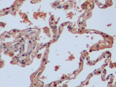 Polyclonal Antibody to Isocitrate Dehydrogenase 1, Soluble (IDH1)