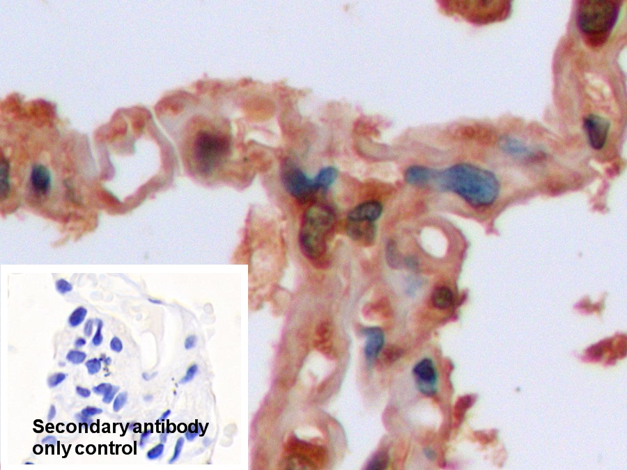 Polyclonal Antibody to Isocitrate Dehydrogenase 1, Soluble (IDH1)