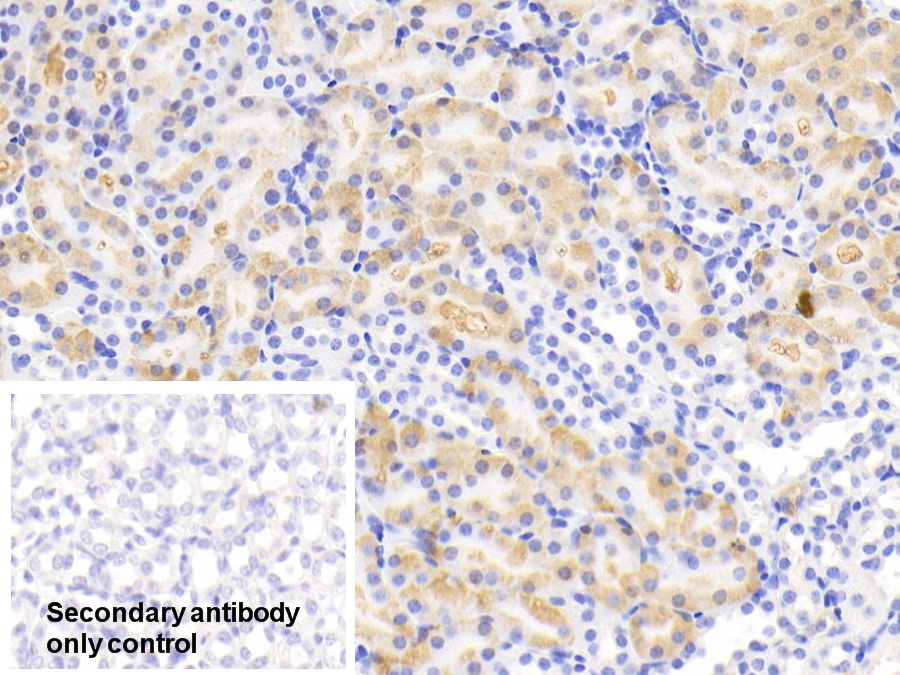 Polyclonal Antibody to Isocitrate Dehydrogenase 1, Soluble (IDH1)