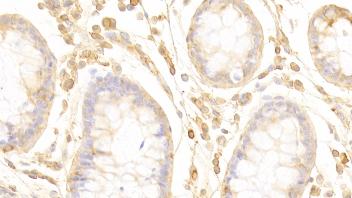 Polyclonal Antibody to Pleckstrin Homology Domain Containing Family A, Member 1 (PLEKHA1)