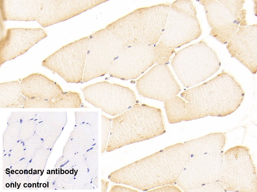 Polyclonal Antibody to Hepatocyte Growth Factor Regulated Tyrosine Kinase Substrate (HGS)