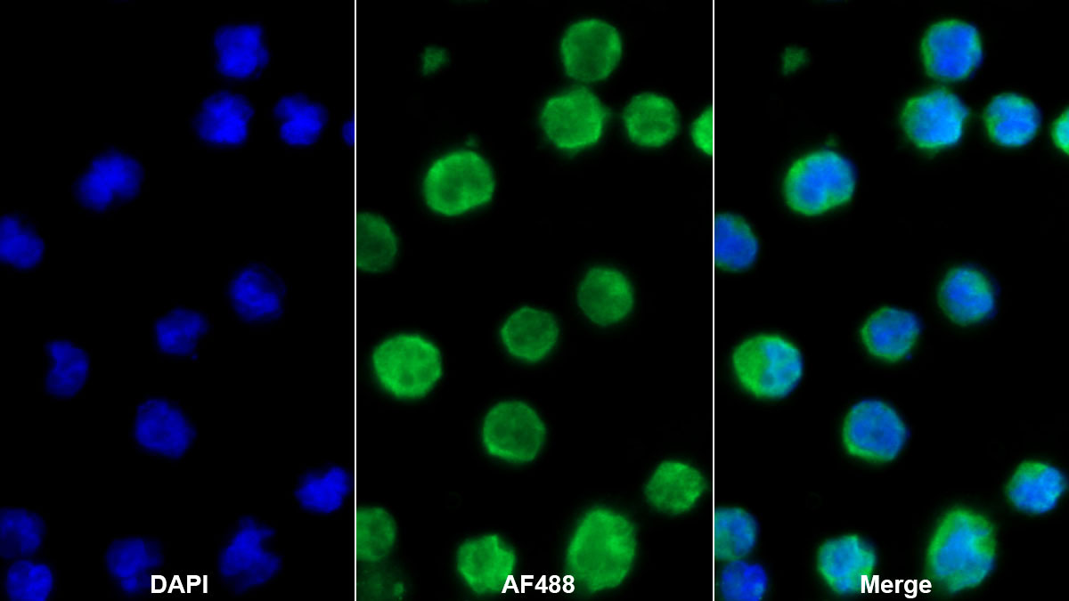 Polyclonal Antibody to Hepatitis A Virus Cellular Receptor 2 (HAVCR2)