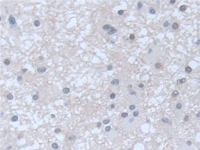 Polyclonal Antibody to Guanylate Cyclase 1 Beta 3 (GUCY1b3)