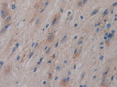 Polyclonal Antibody to Glycosylphosphatidylinositol Specific Phospholipase D1 (GPLD1)