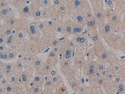 Polyclonal Antibody to Glycosylphosphatidylinositol Specific Phospholipase D1 (GPLD1)