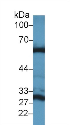 Polyclonal Antibody to Glutaminase 2 (GLS2)