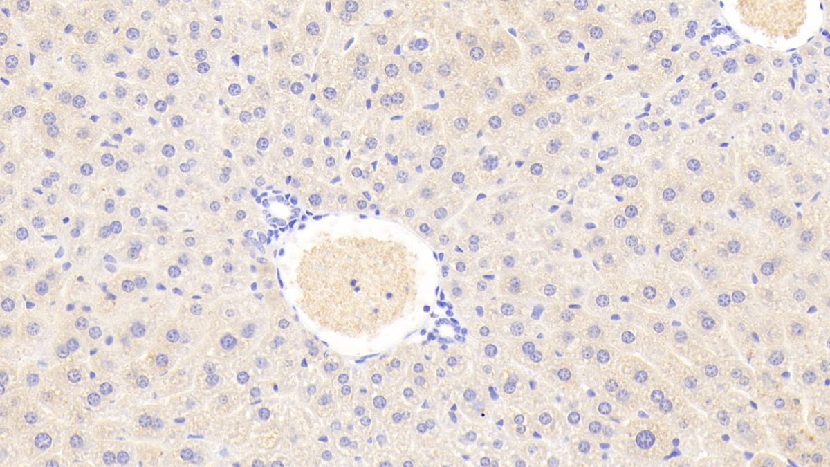 Polyclonal Antibody to Glutaminase 2 (GLS2)