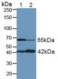 Polyclonal Antibody to Glutaminase (GLS)