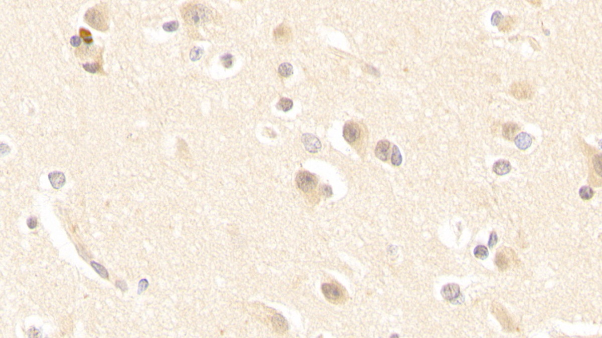 Polyclonal Antibody to Glutaminase (GLS)