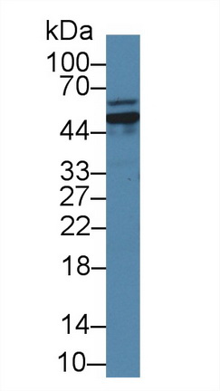 Polyclonal Antibody to Glutaminase (GLS)