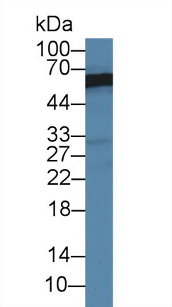 Polyclonal Antibody to Glutaminase (GLS)