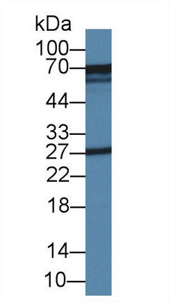 Polyclonal Antibody to Glutaminase (GLS)