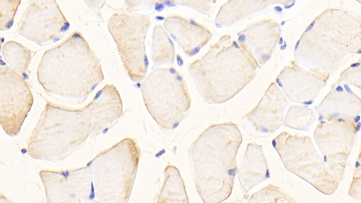 Polyclonal Antibody to Glutaminase (GLS)