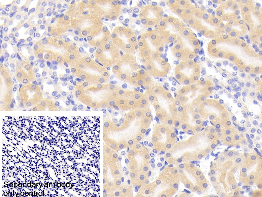 Polyclonal Antibody to Glutaminase (GLS)