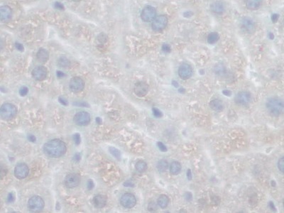 Polyclonal Antibody to Growth Factor, Augmenter Of Liver Regeneration (GFER)