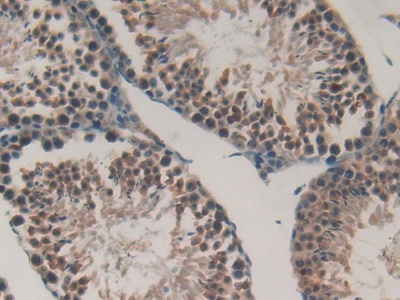 Polyclonal Antibody to Gastrokine 2 (GKN2)