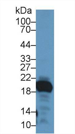 Polyclonal Antibody to Gastrokine 2 (GKN2)