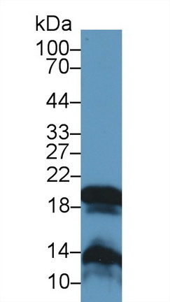 Polyclonal Antibody to Gastrokine 2 (GKN2)