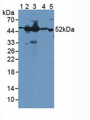 Polyclonal Antibody to Guanine Deaminase (GDA)