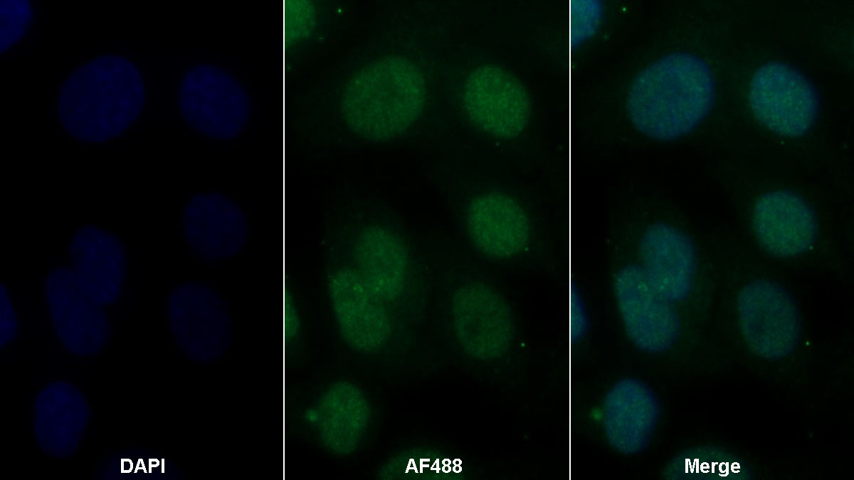 Polyclonal Antibody to Guanine Deaminase (GDA)