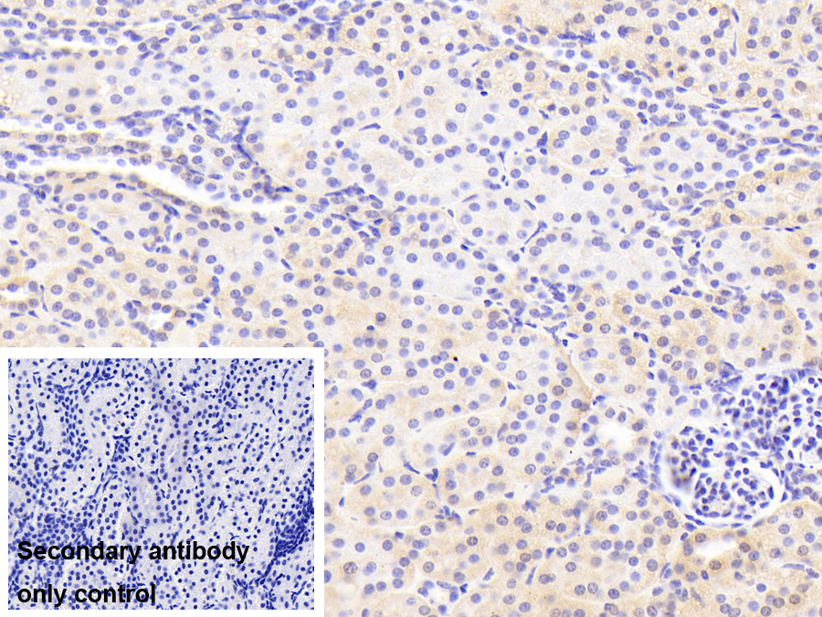 Polyclonal Antibody to Guanine Deaminase (GDA)