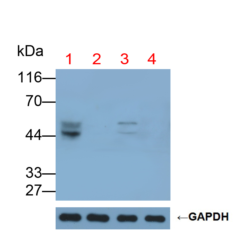 Polyclonal Antibody to Galactose-3-O-Sulfotransferase 1 (GAL3ST1)