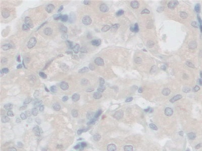 Polyclonal Antibody to Follistatin Like Protein 1 (FSTL1)