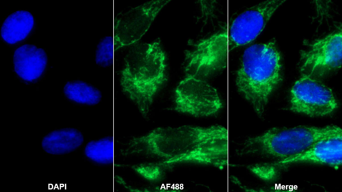 Polyclonal Antibody to Follistatin Like Protein 1 (FSTL1)