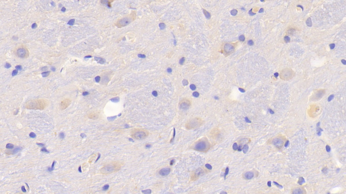 Polyclonal Antibody to Follistatin Like Protein 1 (FSTL1)