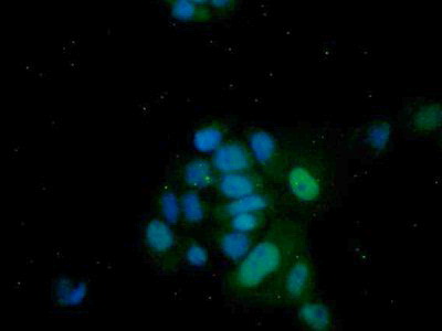 Polyclonal Antibody to FOS Like Antigen 1 (FOSL1)