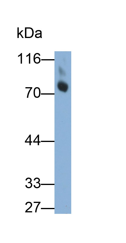 Polyclonal Antibody to Fragile X Mental Retardation 1 (FMR1)