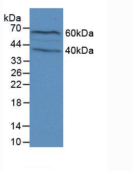 Polyclonal Antibody to Filaggrin (FLG)