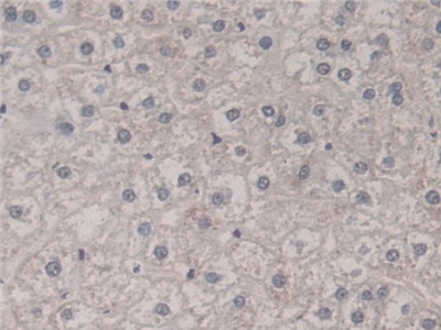 Polyclonal Antibody to Fission 1 (FIS1)