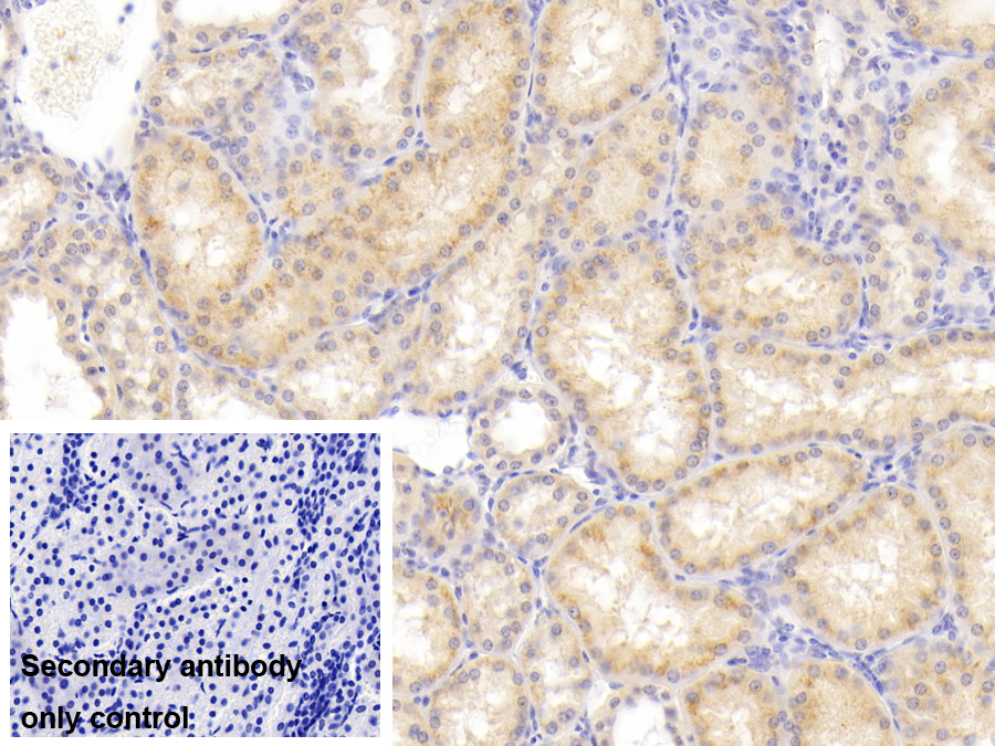 Polyclonal Antibody to Fidgetin (FIGN)