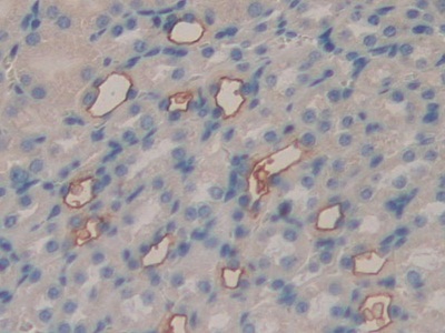 Polyclonal Antibody to Feline Sarcoma Oncogene (FES)