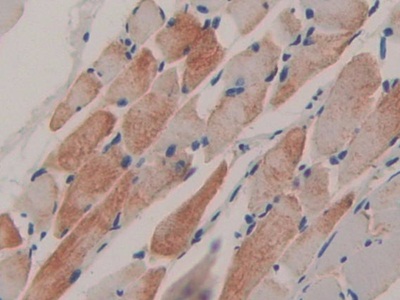 Polyclonal Antibody to Feline Sarcoma Oncogene (FES)