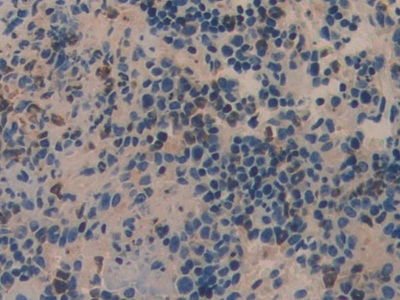 Polyclonal Antibody to Feline Sarcoma Oncogene (FES)