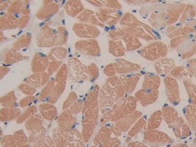 Polyclonal Antibody to Feline Sarcoma Oncogene (FES)