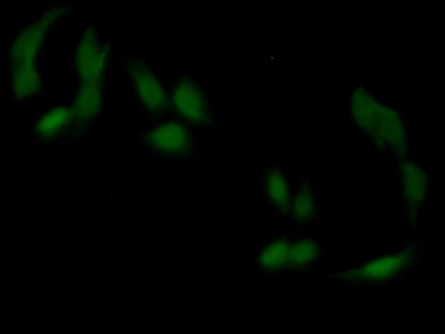 Polyclonal Antibody to Fc Fragment Of IgG Receptor Transporter Alpha (FcgRT)