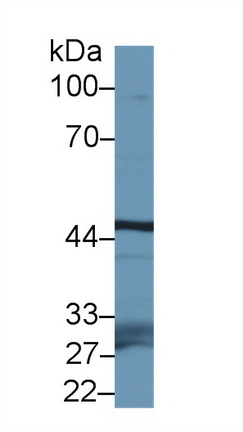 Polyclonal Antibody to F-Box And Leucine Rich Repeat Protein 3 (FBXL3)